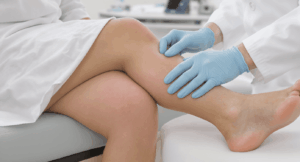 Jambes gonflées un symptôme, pas une maladie