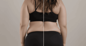 comment agit vraiment le drainage lymphatique